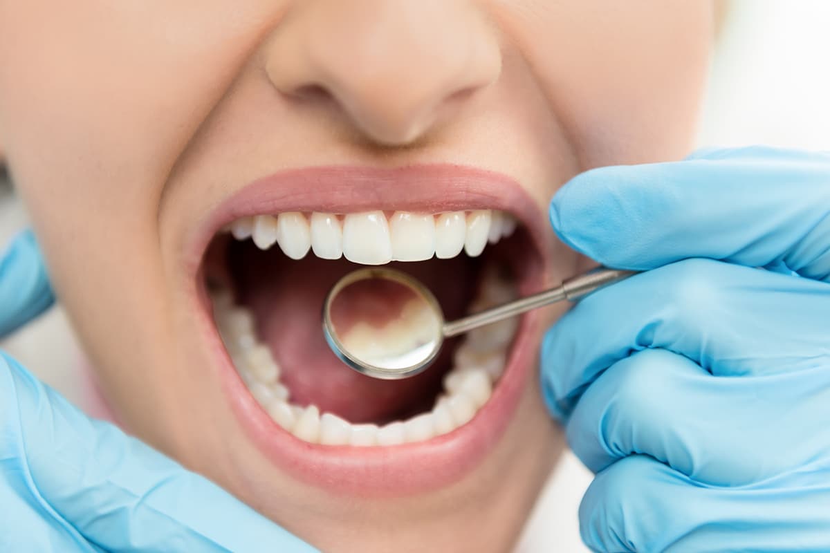 Affordable dental services in edison nj what are your options blog